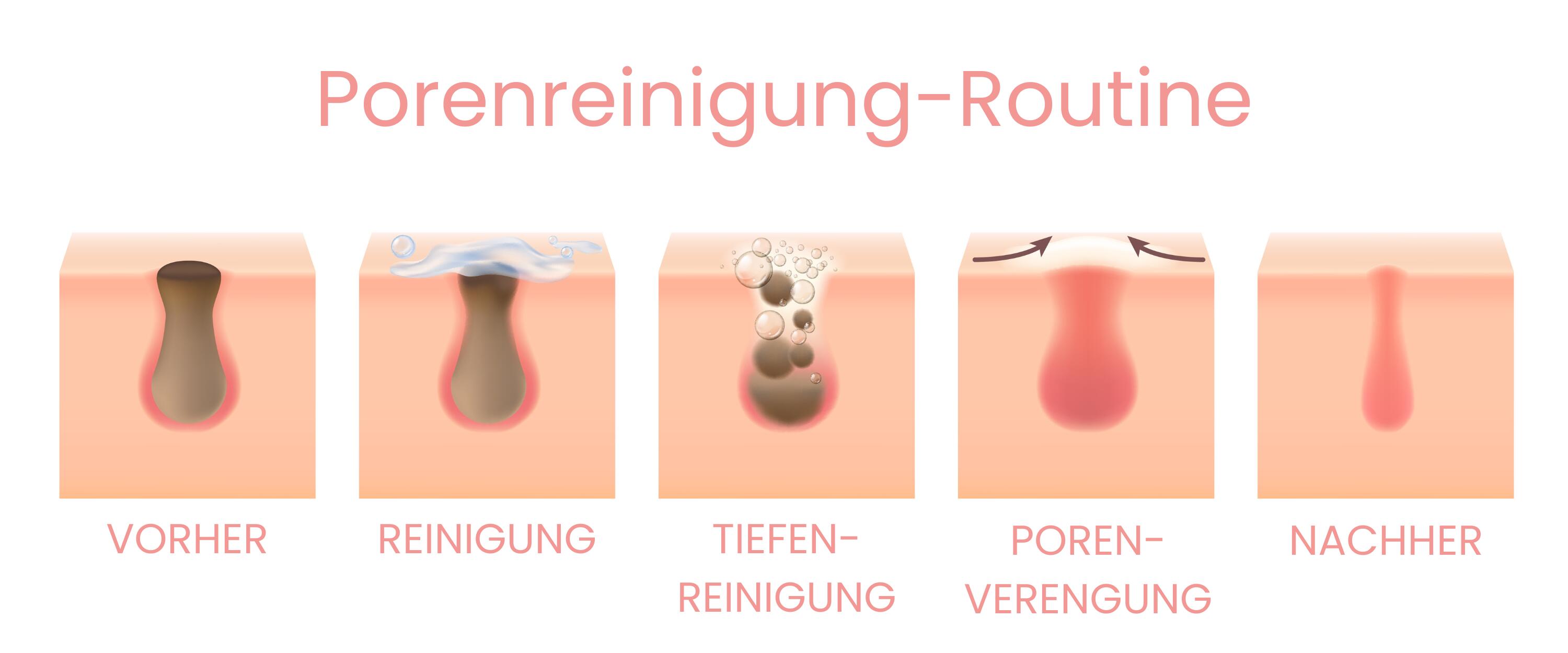 Illustration der Schritte einer Porenreinigung: vor der Reinigung, Waschen, Tiefenreinigung, Porenverengung und Ergebnis.